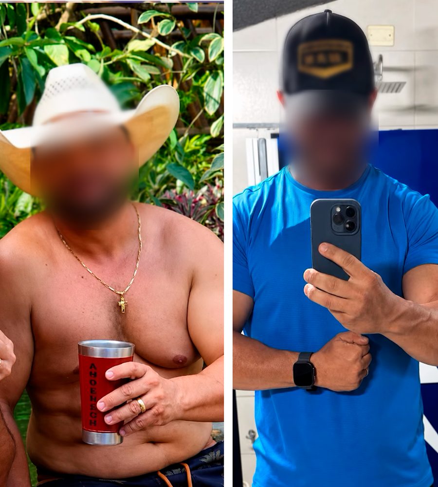 Caso de sucesso 2 de paciente do Dr. Guilherme Rocha