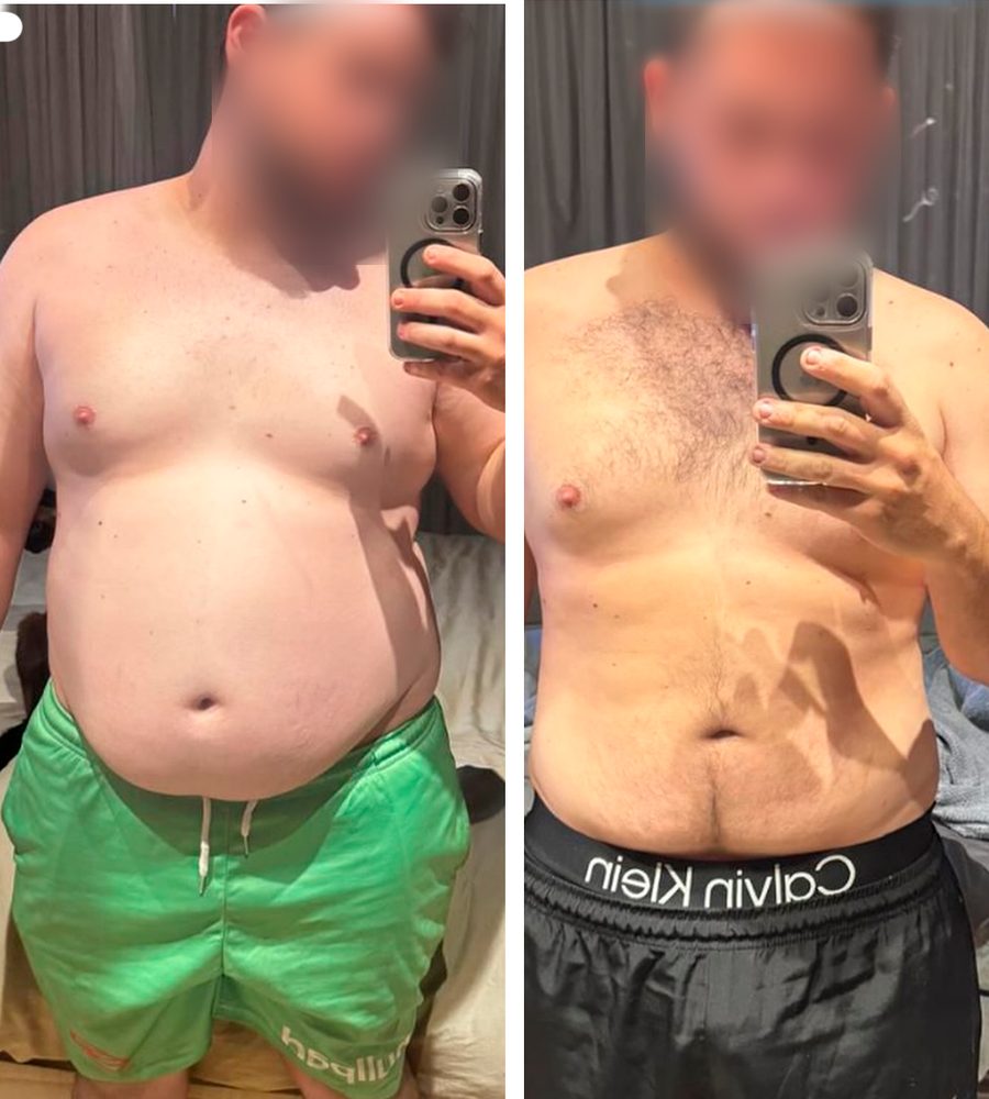 Caso de sucesso 6 de paciente do Dr. Guilherme Rocha